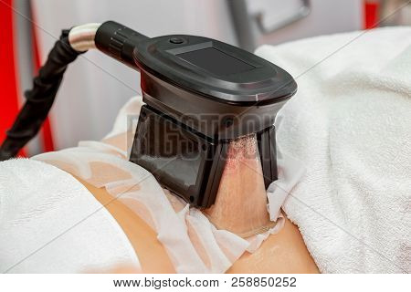 Woman Getting Cryolipolysis Fat Treatment Procedure In Professional Cosmetic Cabinet Or Spa Center