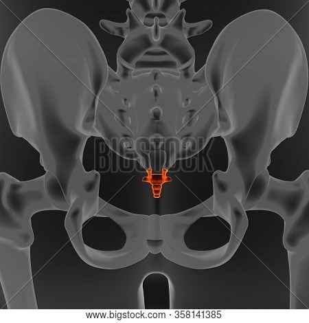 Joint Pain Can Be Caused By Injury Affecting Any Of The Ligaments, Bursae, Or Tendons Surrounding Th