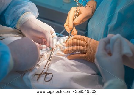 Close-up, The Hands Of Pediatric Surgeons And An Assistant Operating A Small Patient With Behind-the