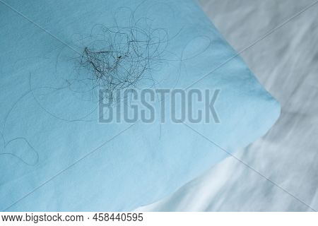 Fallen Long Hair On The Blue Pillow. Baldness And Hair Loss Problem