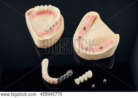 Composition Of Dental Crowns And Orthopedic Components On A Black Background