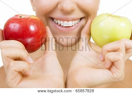 Smiling Girl With Retainer For Teeth And Apple, Isolated On White