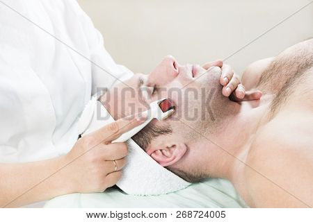 The Man Undergoes The Procedure Of Medical Micro Needle Therapy With A Modern Medical Instrument Der