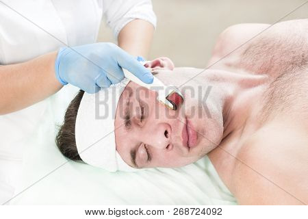 The Man Undergoes The Procedure Of Medical Micro Needle Therapy With A Modern Medical Instrument Der