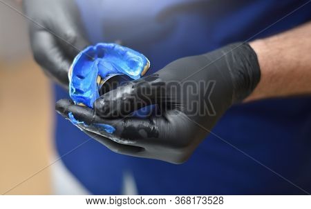 Dentist Doctor Holds A Dental Cast In His Hands. Doctor Holds A Teeth Imprint