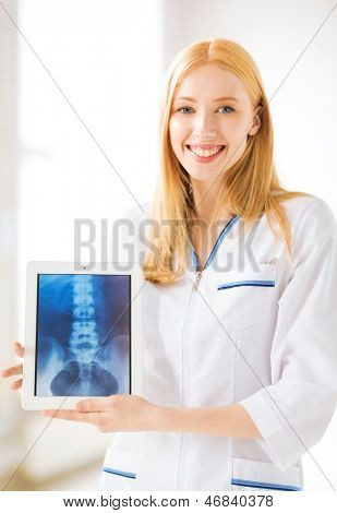 ljusa bild av kvinnliga läkare med röntgen på TabletPC