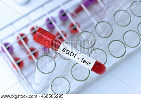 Sgot Test To Look For Abnormalities From Blood,  Blood Sample To Analyze In The Laboratory, Blood In