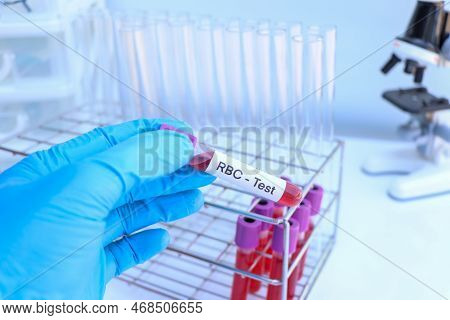 Rbc Test To Look For Abnormalities From Blood,  Blood Sample To Analyze In The Laboratory, Blood In 