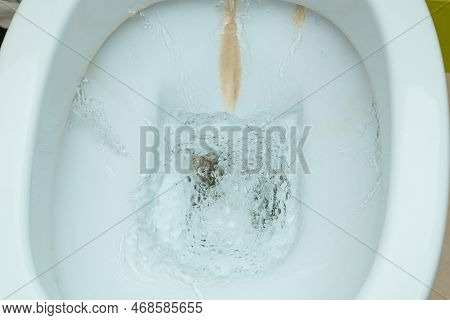 Dirty Toilet Bowl With Limescale Stain Deposits. A Toilet With Traces Of Limescale, Salt And Stone D