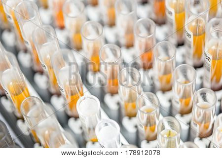 Laboratory glass test tubes filled with orange liquid for an experiment in a science research lab. Analyzes