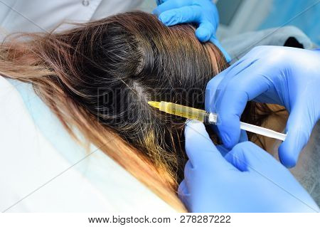 Doctor Cosmetologist Dermatologist Injects The Plasma Into The Scalp Of The Patient. Plasma Treatmen