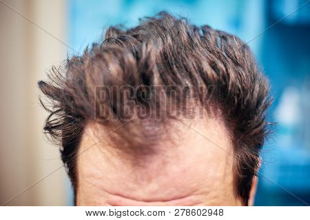Mens Dirty Unkempt Hair Early In The Morning