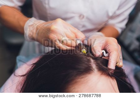 Platelet Rich Plasma Injection Procedure. Hair Growth Stimulation. Prp Therapy Process.