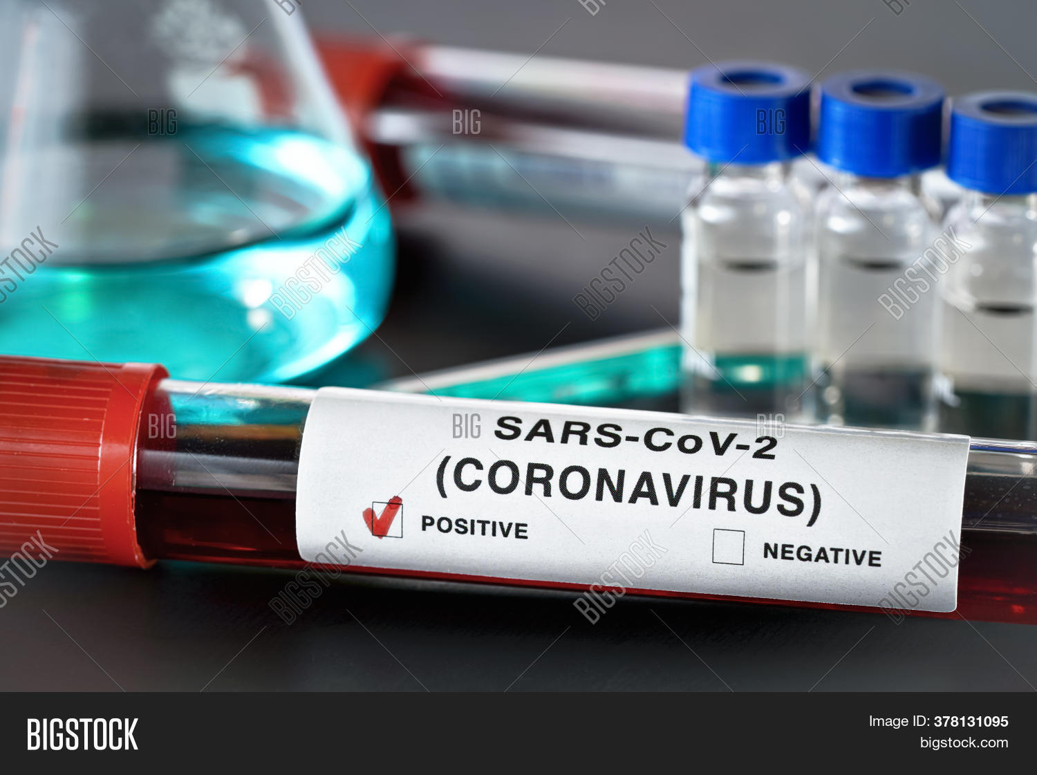 Sample Vial Blood, Image & Photo (Free Trial) Bigstock