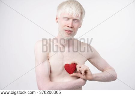 Albinism Albino Man In Studio Dressed T-shirt Isolated On A White Background. Abnormal Deviations. U