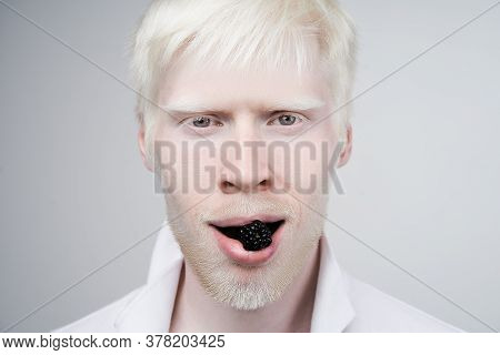 Albinism Happy Albino Man White Skin Hair Studio Dressed T-shirt Isolated White Background. Abnormal