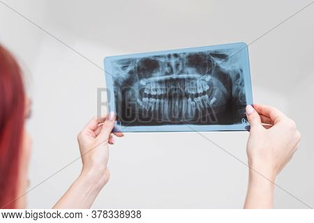 Doctor Orthodontist Analyzes The Orthopantomogram Of The Patient's Jaws To Diagnose