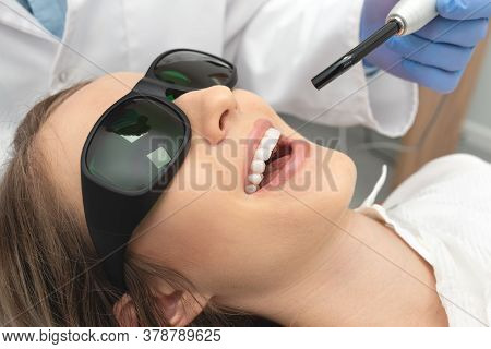Using A Modern Method Of Laser Teeth Treatment. Dental Care, Perfect Smile