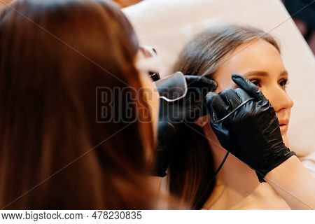 Doctor Is Doing Electroepilation To The Client, Using Electro Needle And Tweezers. Hair Removal Proc