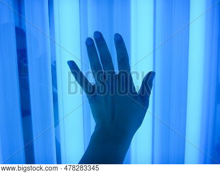 Phototherapy Dermatosis. Treatment Of Skin Diseases - Psoriasis, Ekzemy, Dermatitis, Vitiligo-irradi