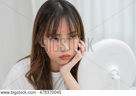 Young Woman Are Worried About Faces Dermatology And Allergic To Steroids In Cosmetics. Sensitive Ski