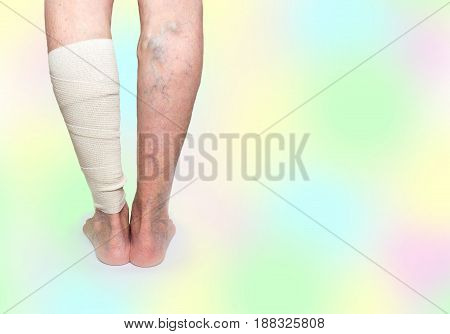 The female legs. Varicose veins. Phlebeurysm. Thrombophlebitis and elastic bandage