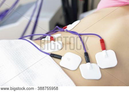 Myostimulation Electrodes Are Placed On The Abdomen. Anti-cellulite Massage Myostimulation For A Bea