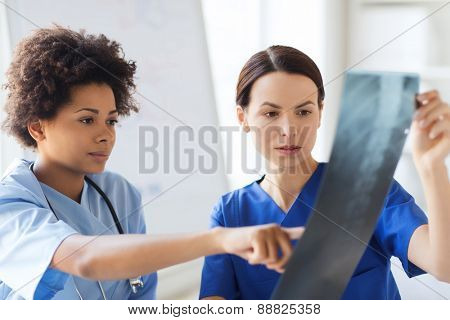 radiology, surgery, people and medicine concept - female doctors looking to and discussing x-ray image at hospital