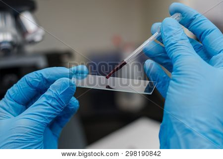 The Veterinarian Putting A Drop Of Blood On The Surface Of A Microscopic Blade
