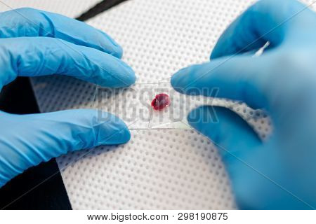 The Veterinarian Is Preparing A Blood Smear