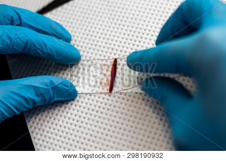 The Veterinarian Is Preparing A Blood Smear
