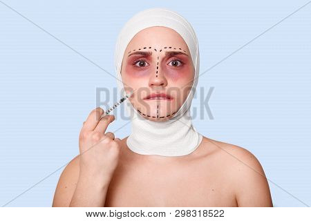 Photo Of Sad Bruised Woman Holds Syringe With Serum, Has Bad Mood, Waits Surgery Procedures. Girls W