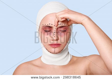 A Beautiful Young Woman Stands Against Blue Wall With Bandage On Her Head. Girl Suffers From Awful H