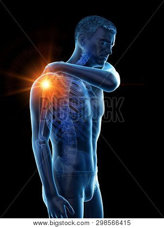 3d rendered medically accurate illustration of a man having a painful shoulder joint