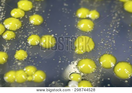 Bacteria Grown From Skin Smear, Colonies Of Micrococcus Luteus And Staphylococcus Epidermidis On Pet