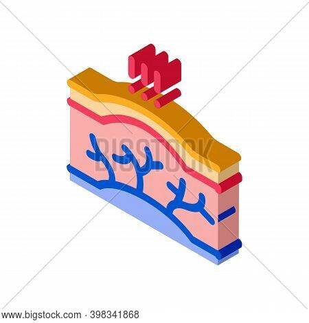 Varicose Veins Disease Color Icon Vector. Isometric Varicose Veins Disease Sign. Color Isolated Symb