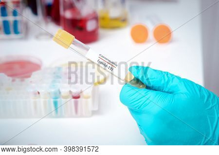 Test Tubes Containing Plasma Extracted From The Blood Of People Who Had Been Ill With Coronavirus, C