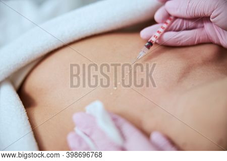 Woman Being Treated For The Decolletage Wrinkles