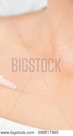 Near Eye Injection At Spa Salon. Doctor Hands. Closeup. High Quality. Pretty Female Patient. Beauty 