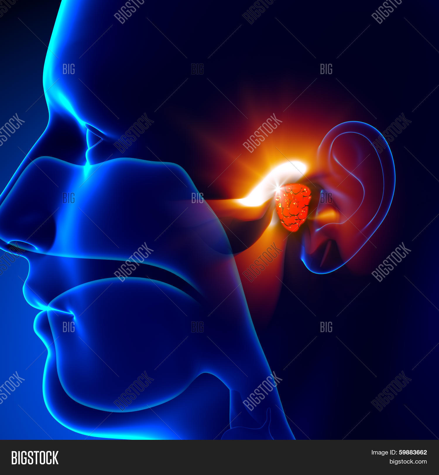 Adenoids - Ear Image & Photo (Free Trial) | Bigstock
