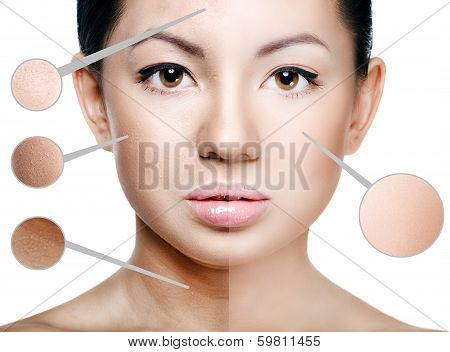 Face of beautiful young woman before and after retouch