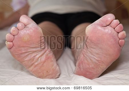 Senior Leg Problems