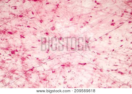 Human loose connective tissue, light photomicrograph, hematoxylin and eosin staining
