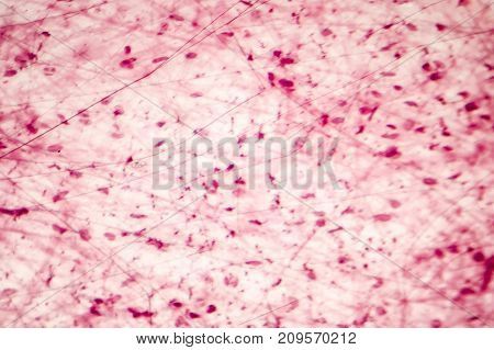 Human loose connective tissue, light photomicrograph, hematoxylin and eosin staining
