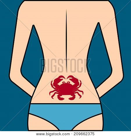 Lumbago - pain in lumbar. Back of woman with sick spine. - Stock vector