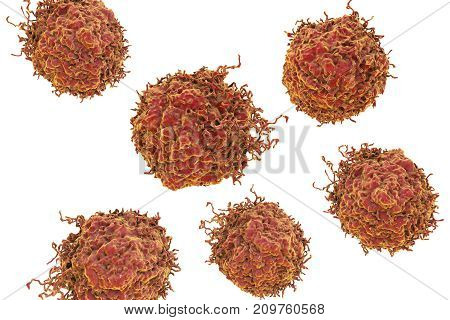 Prostate cancer cells, 3D illustration. Prostate cancer awareness image