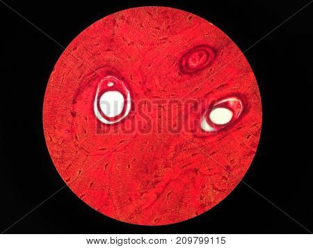 Histology of human compact bone tissue under microscope view