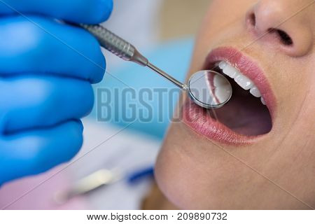 Close up of dentist holding angled mirror by woman at medical clinic