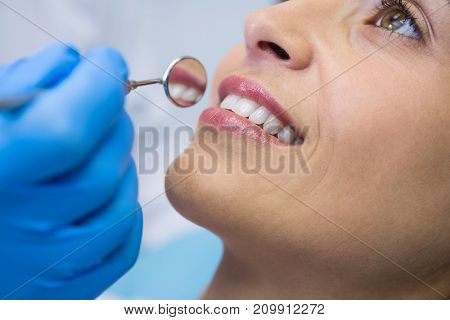 Close up of dentist holding angled mirror by smiling woman at clinic
