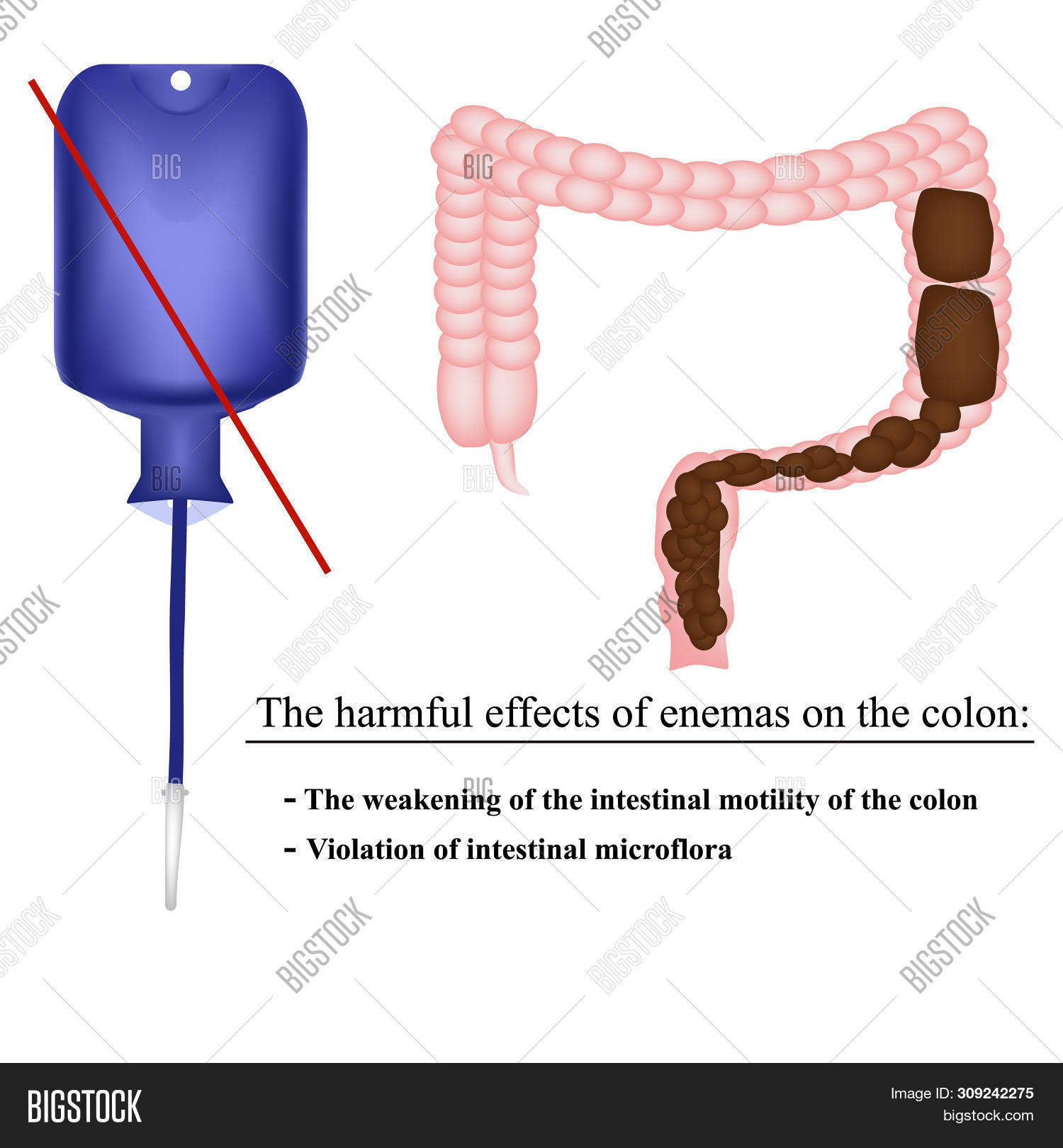Harmful Effects Enemas Image & Photo (Free Trial) Bigstock